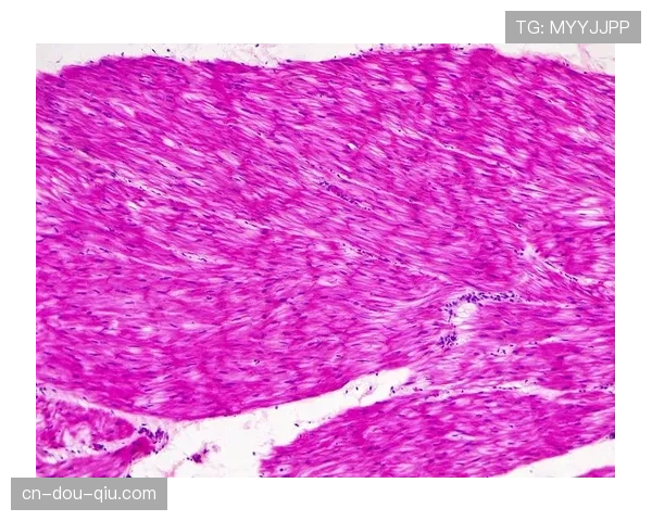 格雷罗左腿筋肌肉纤维撕裂至少休战两周